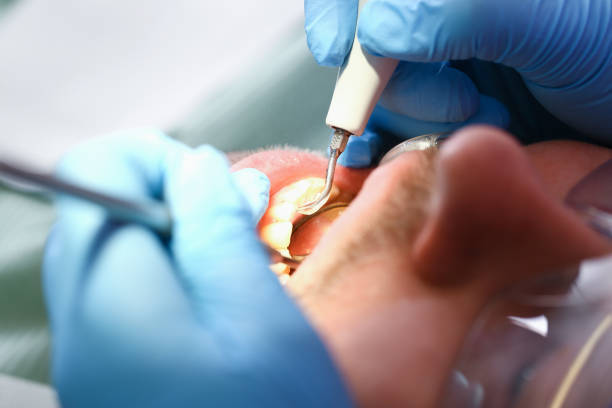 Best Walk-In Emergency Dental Services in Ballwin, MO