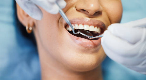 Best Emergency Cosmetic Dentistry (e.g., broken veneers) in Ballwin, MO