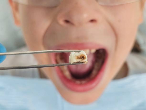 Best Emergency Care for Gum Disease in Ballwin, MO